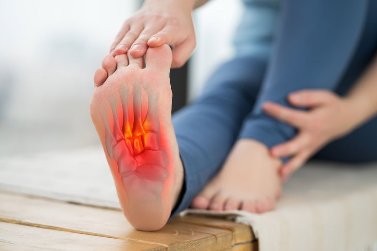 Arthrose im Fuß was hilft Hausmittel: Die wirksamsten Tipps gegen Schmerzen und Entzündungen