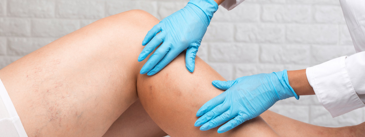 lymphologe in der nähe